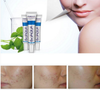 Removal Acne Scar Marks Cream Treatment Face Care Whitening Moisturizing