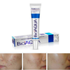 Removal Acne Scar Marks Cream Treatment Face Care Whitening Moisturizing